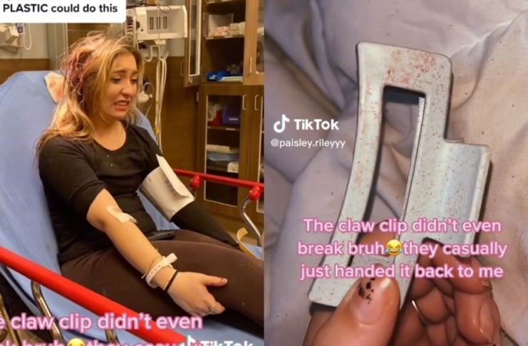 開車別戴鯊魚夾!她車禍一摔竟被「刺穿頭殼」 後腦杓噴血慘照曝